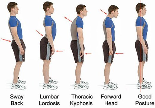 Posture Improvement Clinic